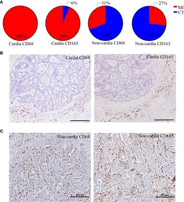 The Distinct Impact of TAM Infiltration on the Prognosis of Patients With Cardia and Non-Cardia Gastric Cancer and Its Association With H. pylori Infection